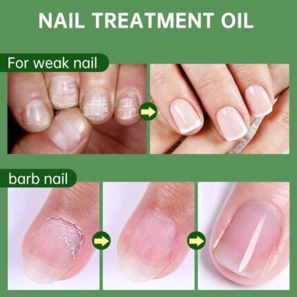 AUQUEST Nail Nutrition Oil Pen - Cuticle Revitalizer Gel