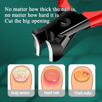 Anti-Splash Nail Clippers for Onychomycosis